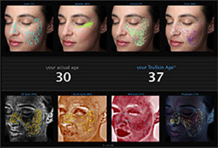 VISIA Skin Imaging