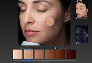 VISIA Skin Imaging