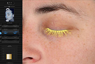 VISIA Skin Imaging