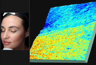 VISIA Skin Imaging