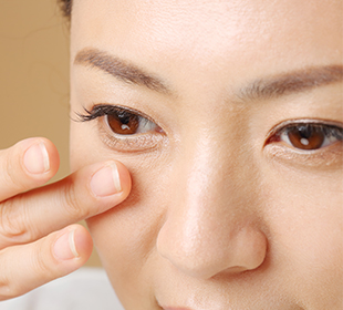 Eyelid Turned Out Ectropion