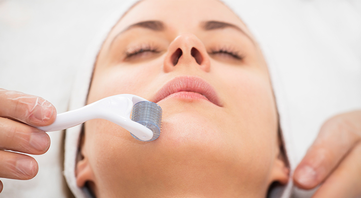 Microneedling
